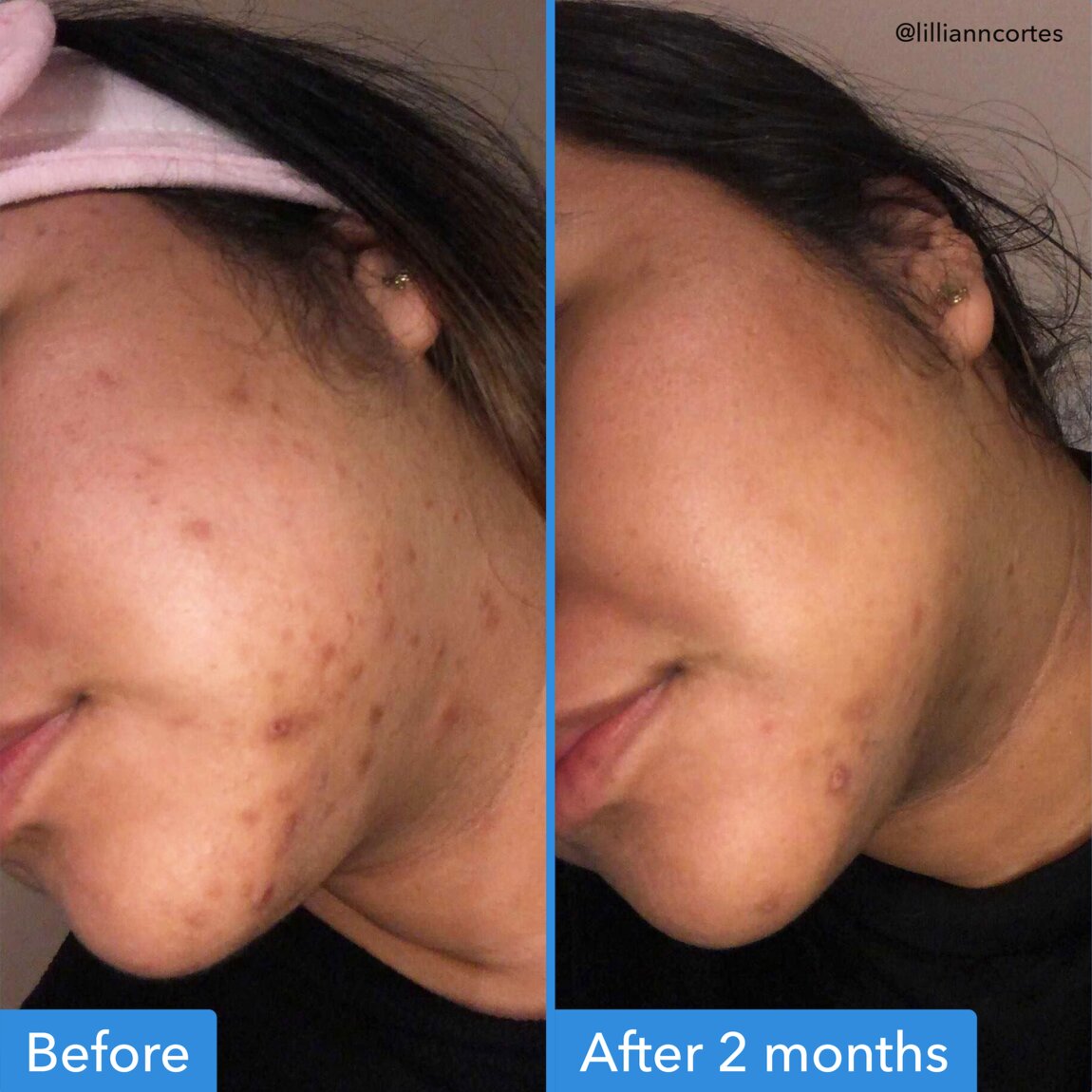 discoloration-correcting-serum-n1 zb_p.jpg