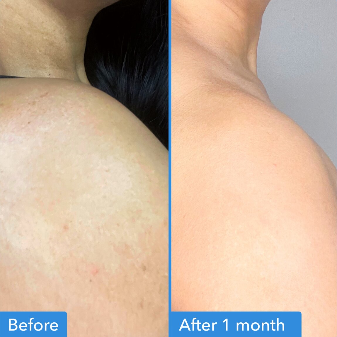 discoloration-correcting-body-treatment-y3 zb_p.jpg