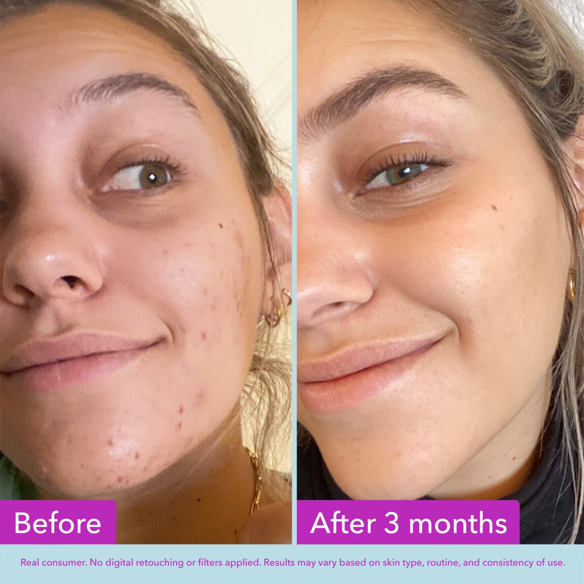 niacinamide-brightening-toner-z8 zb_p.jpg